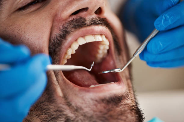 Best Emergency Denture Repair in Dayton, OR