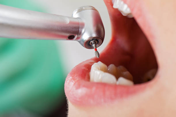 Best Emergency Treatment for Dental Infections or Abscesses in Dayton, OR